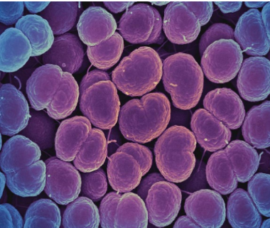 Micrografia eletrônica de varredura colorida da bactéria Neisseria gonorrhoeae, que causa gonorréia. NIAID