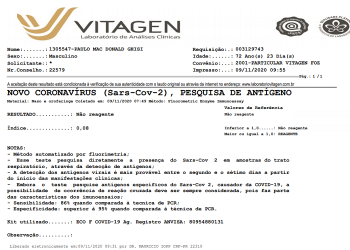 Resultado da testagem de Paulo divulgado pela assessoria dele.